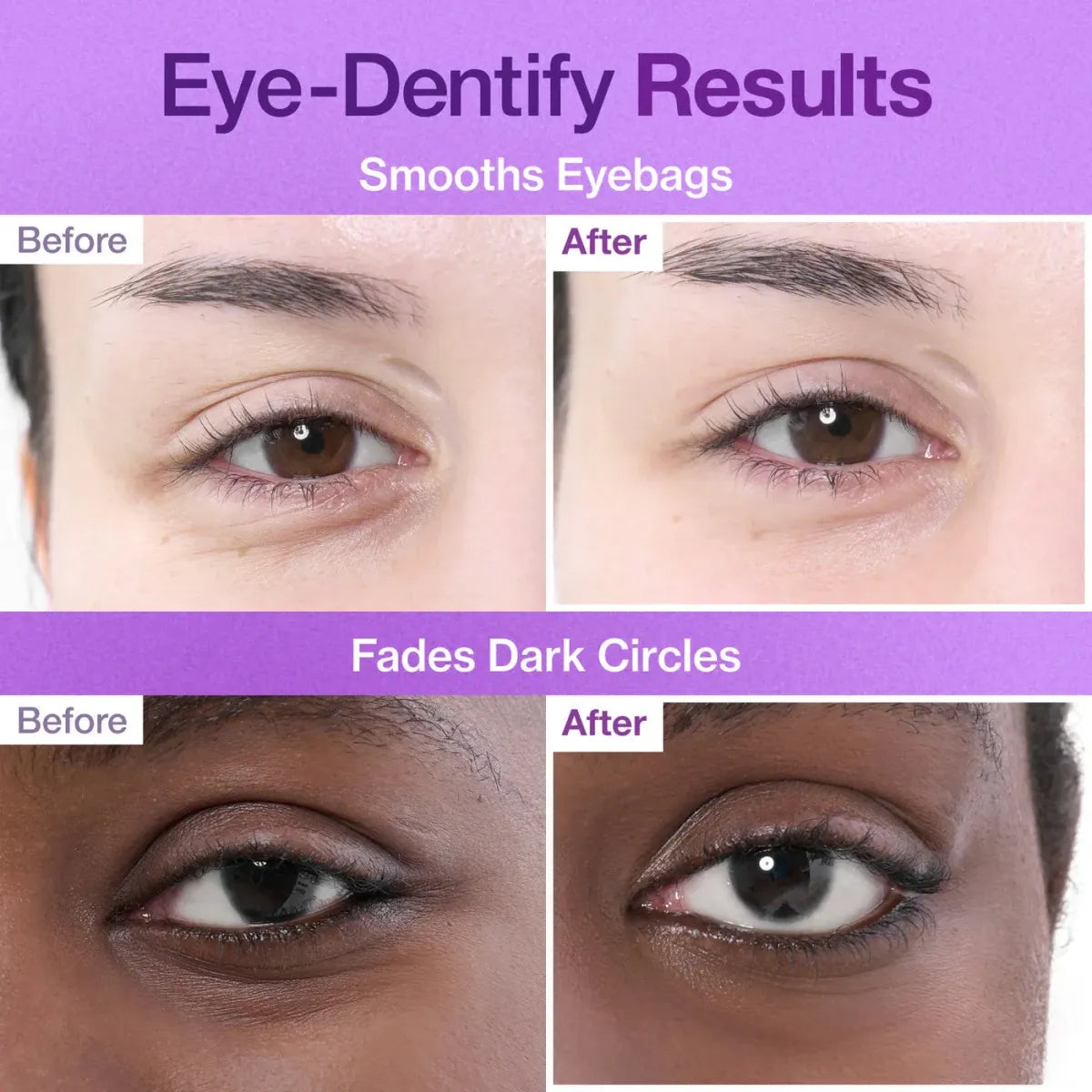 Numbuzin No.9 NAD+ Collagen Under Eye Patches 5EA